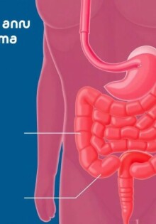 Nausea and Vomiting in Appendicitis: Understanding the Key Symptoms