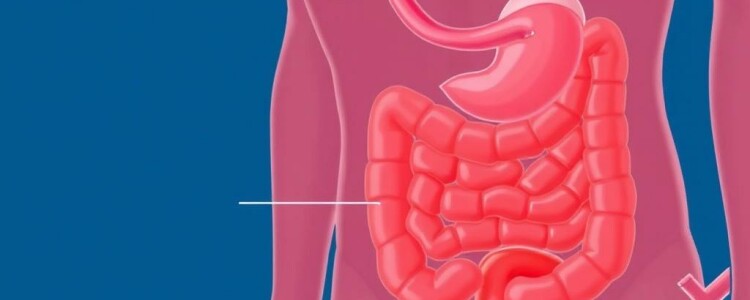 Nausea and Vomiting in Appendicitis: Understanding the Key Symptoms