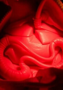 Krankschreibung nach Appendektomie: Was Patienten wissen müssen