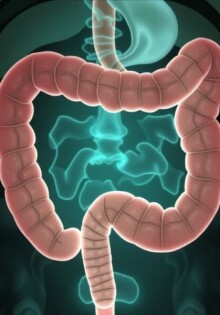 Komplizierte Appendizitis: Abszess und Peritonitis – Wenn der Blinddarm gefährlich wird