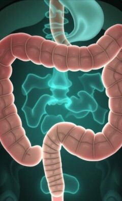 Komplizierte Appendizitis: Abszess und Peritonitis – Wenn der Blinddarm gefährlich wird