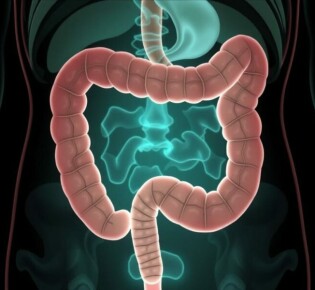 Komplizierte Appendizitis: Abszess und Peritonitis – Wenn der Blinddarm gefährlich wird