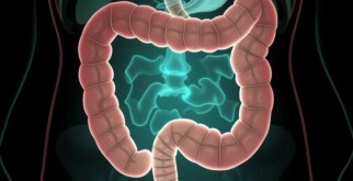 Komplizierte Appendizitis: Abszess und Peritonitis – Wenn der Blinddarm gefährlich wird