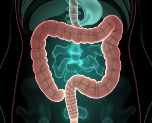 Komplizierte Appendizitis: Abszess und Peritonitis – Wenn der Blinddarm gefährlich wird