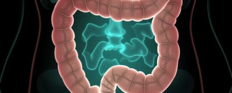 Komplizierte Appendizitis: Abszess und Peritonitis – Wenn der Blinddarm gefährlich wird