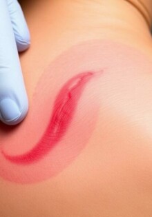 Cicatrización: cuidados para minimizar cicatrices y recuperar la confianza en tu piel