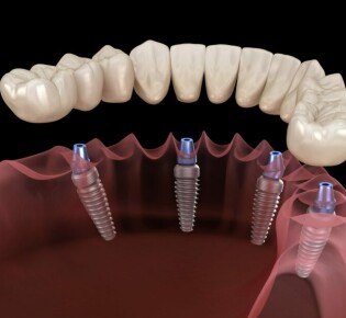 Мегатерии: гиганты из прошлого, о которых вы никогда не слышали
