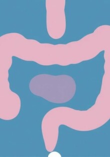 Replanteando la apendicitis: Lecciones del estudio NOTA (Tratamiento no operatorio de la apendicitis aguda)