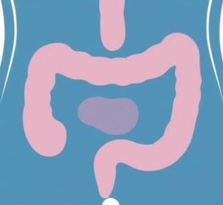 Replanteando la apendicitis: Lecciones del estudio NOTA (Tratamiento no operatorio de la apendicitis aguda)