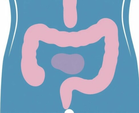 Replanteando la apendicitis: Lecciones del estudio NOTA (Tratamiento no operatorio de la apendicitis aguda)