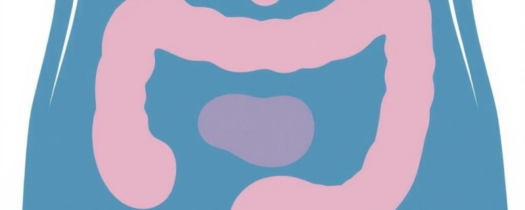 Replanteando la apendicitis: Lecciones del estudio NOTA (Tratamiento no operatorio de la apendicitis aguda)