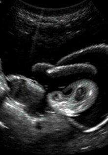 Befundung einer Abdomen-Sonographie beim Akutpatienten: guía práctica y conversacional para el clínico sonografista