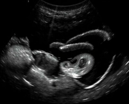 Befundung einer Abdomen-Sonographie beim Akutpatienten: guía práctica y conversacional para el clínico sonografista