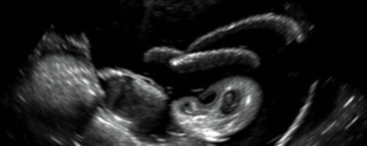 Befundung einer Abdomen-Sonographie beim Akutpatienten: guía práctica y conversacional para el clínico sonografista