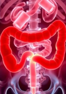 ¿Se puede prevenir la apendicitis? Un vistazo cercano a la evidencia