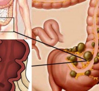 Кто смарт всего животного царства? Самое умное животное на планете!