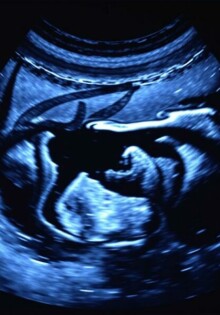 Bildgebende Verfahren: Ultraschall (Sonographie) des Abdomens — Guía práctica y conversacional para entender la ecografía abdominal