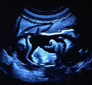 Bildgebende Verfahren: Ultraschall (Sonographie) des Abdomens — Guía práctica y conversacional para entender la ecografía abdominal