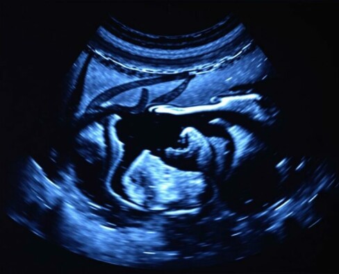 Bildgebende Verfahren: Ultraschall (Sonographie) des Abdomens — Guía práctica y conversacional para entender la ecografía abdominal