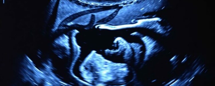 Bildgebende Verfahren: Ultraschall (Sonographie) des Abdomens — Guía práctica y conversacional para entender la ecografía abdominal