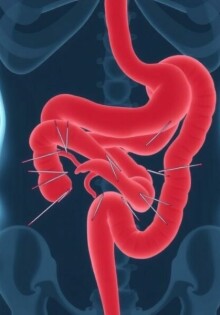 ¿Dolor de vientre que no pasa? Descifrando los síntomas principales de la apendicitis aguda