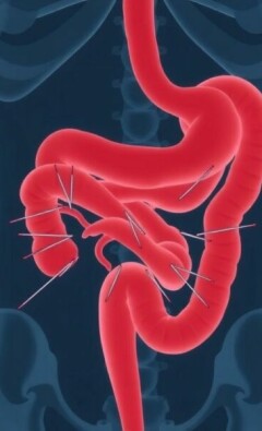 ¿Dolor de vientre que no pasa? Descifrando los síntomas principales de la apendicitis aguda