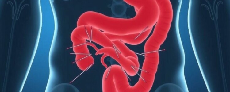 ¿Dolor de vientre que no pasa? Descifrando los síntomas principales de la apendicitis aguda