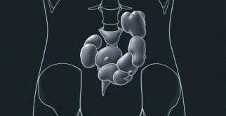 Plastrón apendicular: comprender, reconocer y manejar una complicación silenciosa de la apendicitis