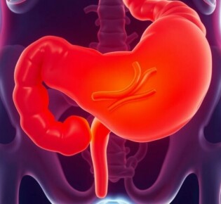 Fremdkörper im Appendix: Eine seltene, aber faszinierende Ursache für Appendizitis