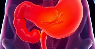 Fremdkörper im Appendix: Eine seltene, aber faszinierende Ursache für Appendizitis