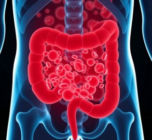 Understanding White Blood Cell Count in Appendicitis: What Does It Really Tell Us?