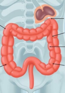 Le diagnostic différentiel de l’appendicite: cómo distinguir diverticulitis, salpingitis y otras imitadoras