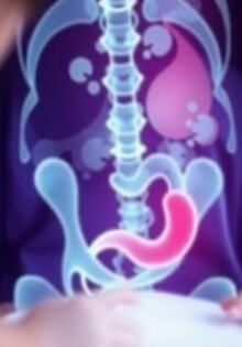 El rompecabezas del apéndice: por qué diagnosticar apendicitis en niños parece una misión imposible