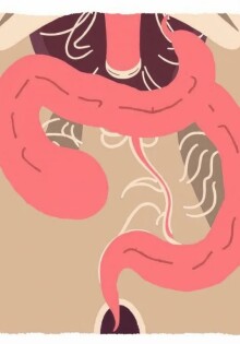 ¿Puede la apendicitis curarse sola? Mitos y realidades