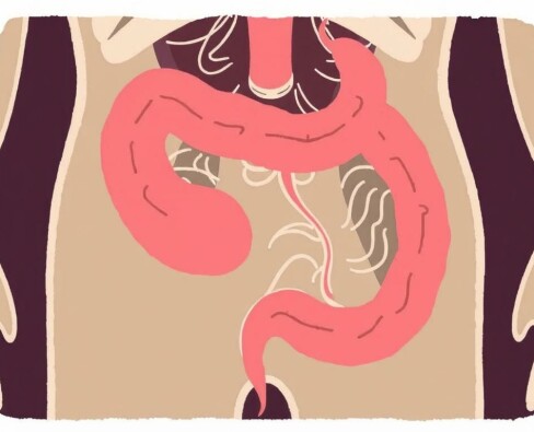 ¿Puede la apendicitis curarse sola? Mitos y realidades