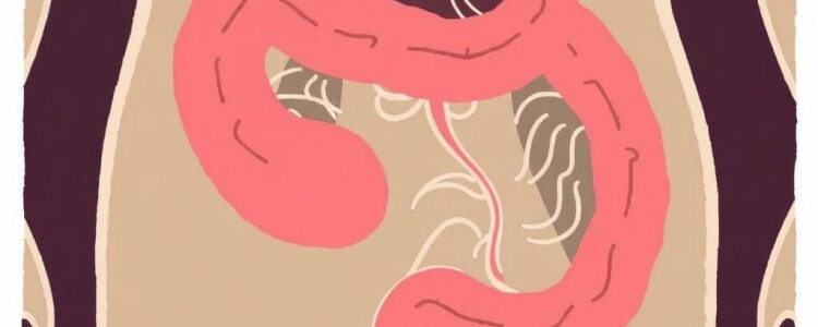 ¿Puede la apendicitis curarse sola? Mitos y realidades