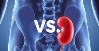 Appendicitis vs. Kidney Stones: Understanding the Differences and Managing the Pain