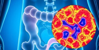 Blinddarm und Multiple Sklerose – Eine überraschende Verbindung?