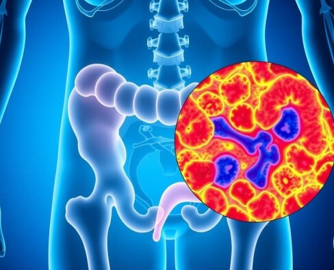 Blinddarm und Multiple Sklerose – Eine überraschende Verbindung?
