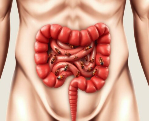 Infecciones parasitarias que pueden causar apendicitis: cuando un parásito se esconde tras el dolor abdominal