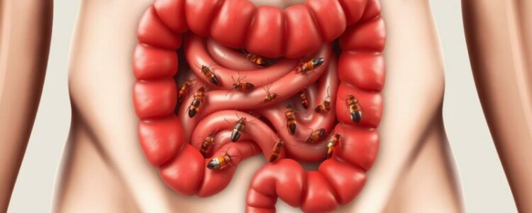 Infecciones parasitarias que pueden causar apendicitis: cuando un parásito se esconde tras el dolor abdominal