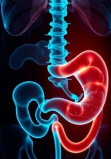 Cuando el dolor no es tan claro: desafíos en el diagnóstico de apendicitis en mujeres