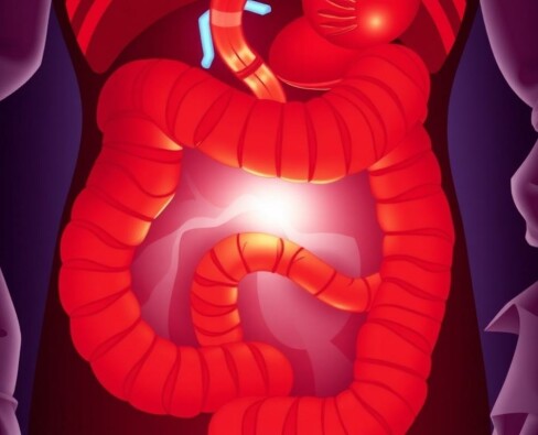 Cuando el apéndice duele más: Apendicitis en personas inmunocomprometidas