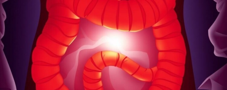 Cuando el apéndice duele más: Apendicitis en personas inmunocomprometidas