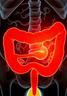 ¿Puede existir la apendicitis crónica? Debatiendo el concepto