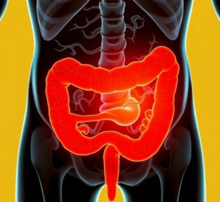 ¿Puede existir la apendicitis crónica? Debatiendo el concepto