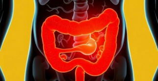 ¿Puede existir la apendicitis crónica? Debatiendo el concepto