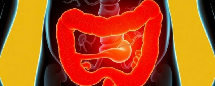 ¿Puede existir la apendicitis crónica? Debatiendo el concepto