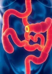 Appendicitis and Bowel Obstruction: Understanding Causes, Symptoms, and Treatments