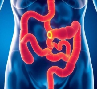 Appendicitis and Bowel Obstruction: Understanding Causes, Symptoms, and Treatments